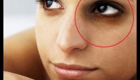 العناية بالبشرة للهالات السوداء: استراتيجيات لتفتيح منطقة العين