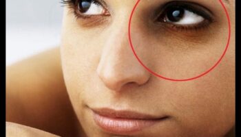 العناية بالبشرة للهالات السوداء: استراتيجيات لتفتيح منطقة العين